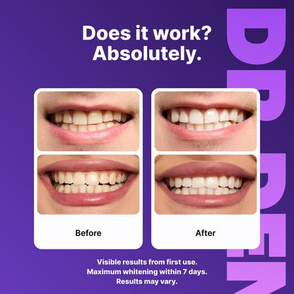 Purple Teeth Whitening Strips - 7/21 Whitening Sessions - Safe for Enamel - Non Sensitive Teeth Whitening - Peroxide-Free
