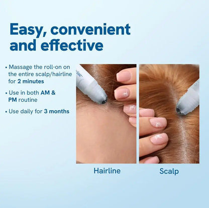 Hair BallEssence Be-Bodywise 3 Rosemary Hair Growth